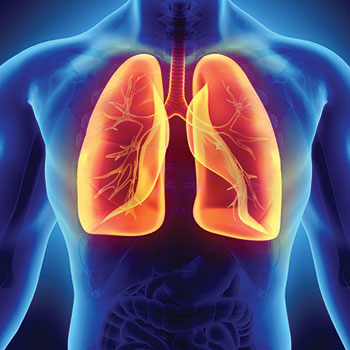 low dose CT lung screening